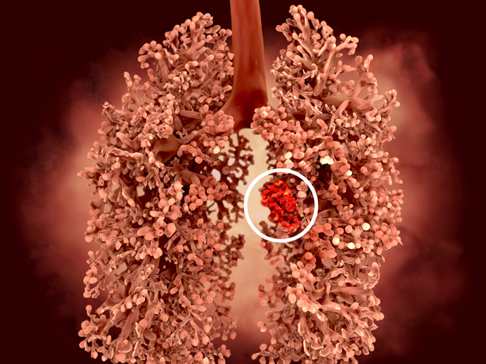 graphic art of lungs